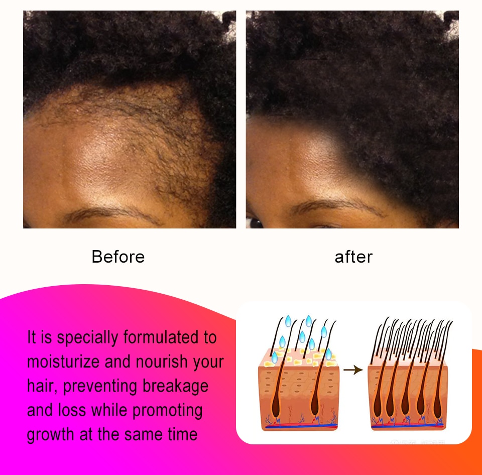 African Crazy Hair Growth Product Traction Alopecia Chebe Powder Hair Growth Oil Anti Hair Loss Treatment Spray Hair Care Sevich