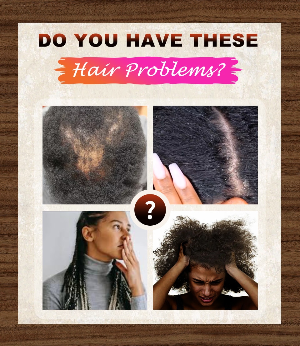 African Crazy Hair Growth Product Traction Alopecia Chebe Powder Hair Growth Oil Anti Hair Loss Treatment Spray Hair Care Sevich