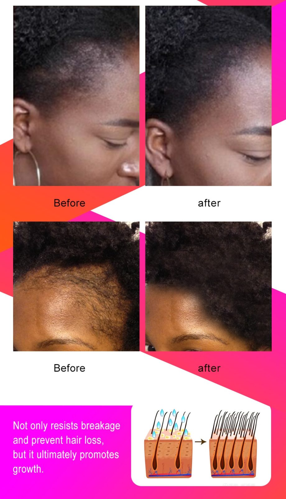 African Crazy Hair Growth Product Traction Alopecia Chebe Powder Hair Growth Oil Anti Hair Loss Treatment Spray Hair Care Sevich