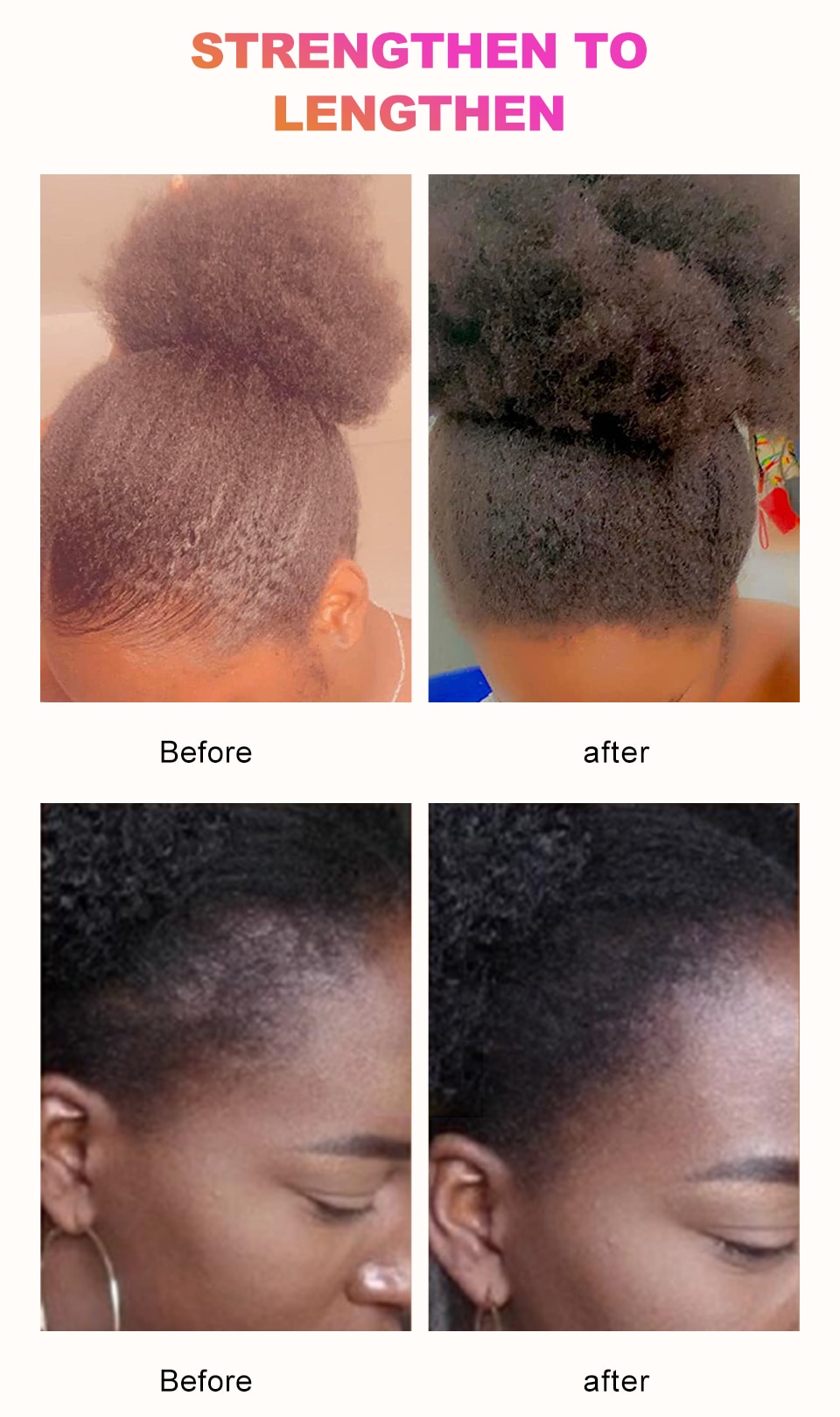 African Crazy Hair Growth Product Traction Alopecia Chebe Powder Hair Growth Oil Anti Hair Loss Treatment Spray Hair Care Sevich