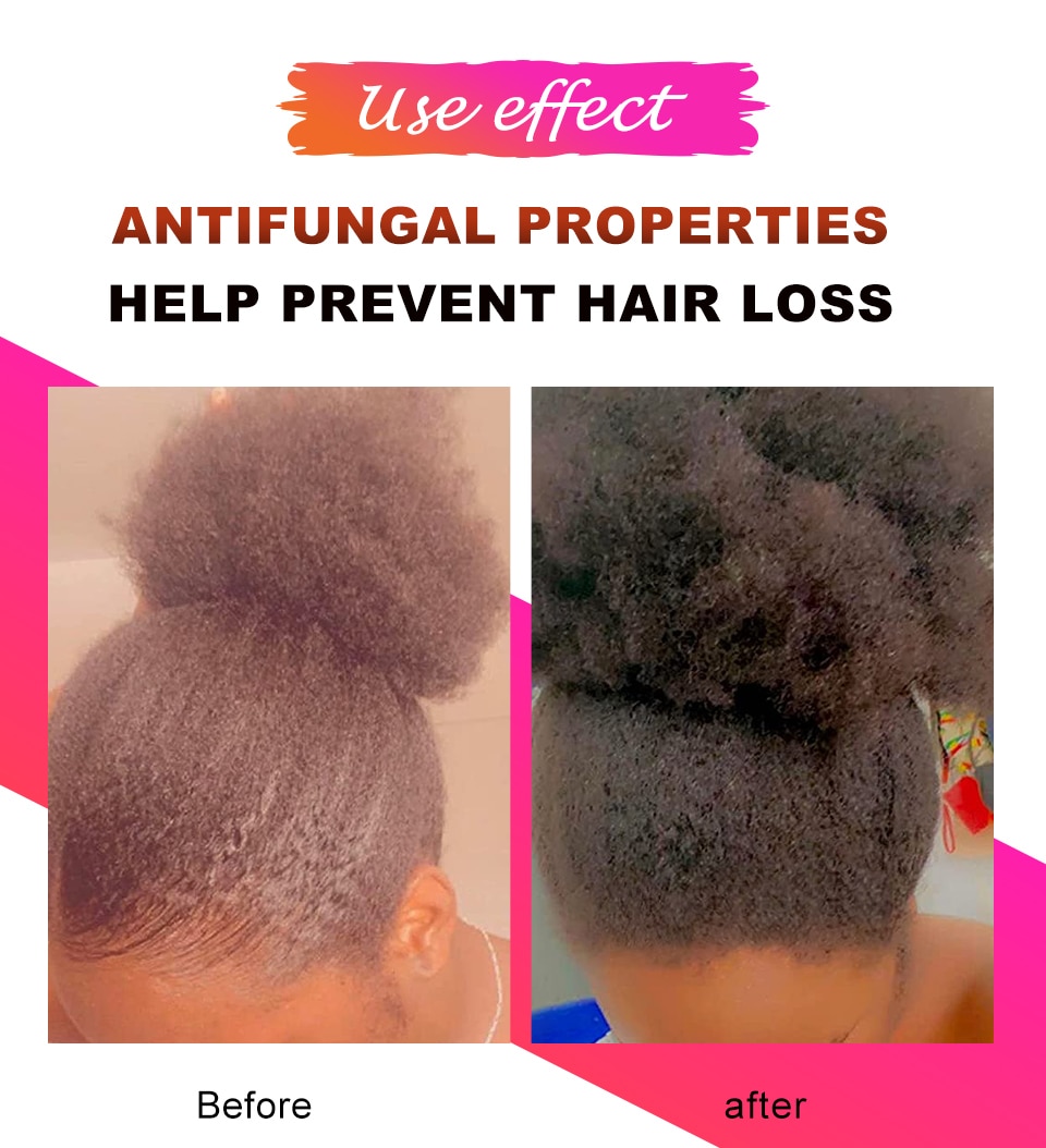 African Crazy Hair Growth Product Traction Alopecia Chebe Powder Hair Growth Oil Anti Hair Loss Treatment Spray Hair Care Sevich