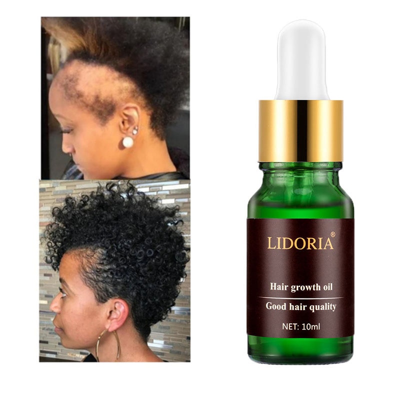 Hair Faster Growth Serum Treatment Anti-Hair Loss Preventing For Thinning Hair Thickening Reawakening Natural Beauty Hair Care