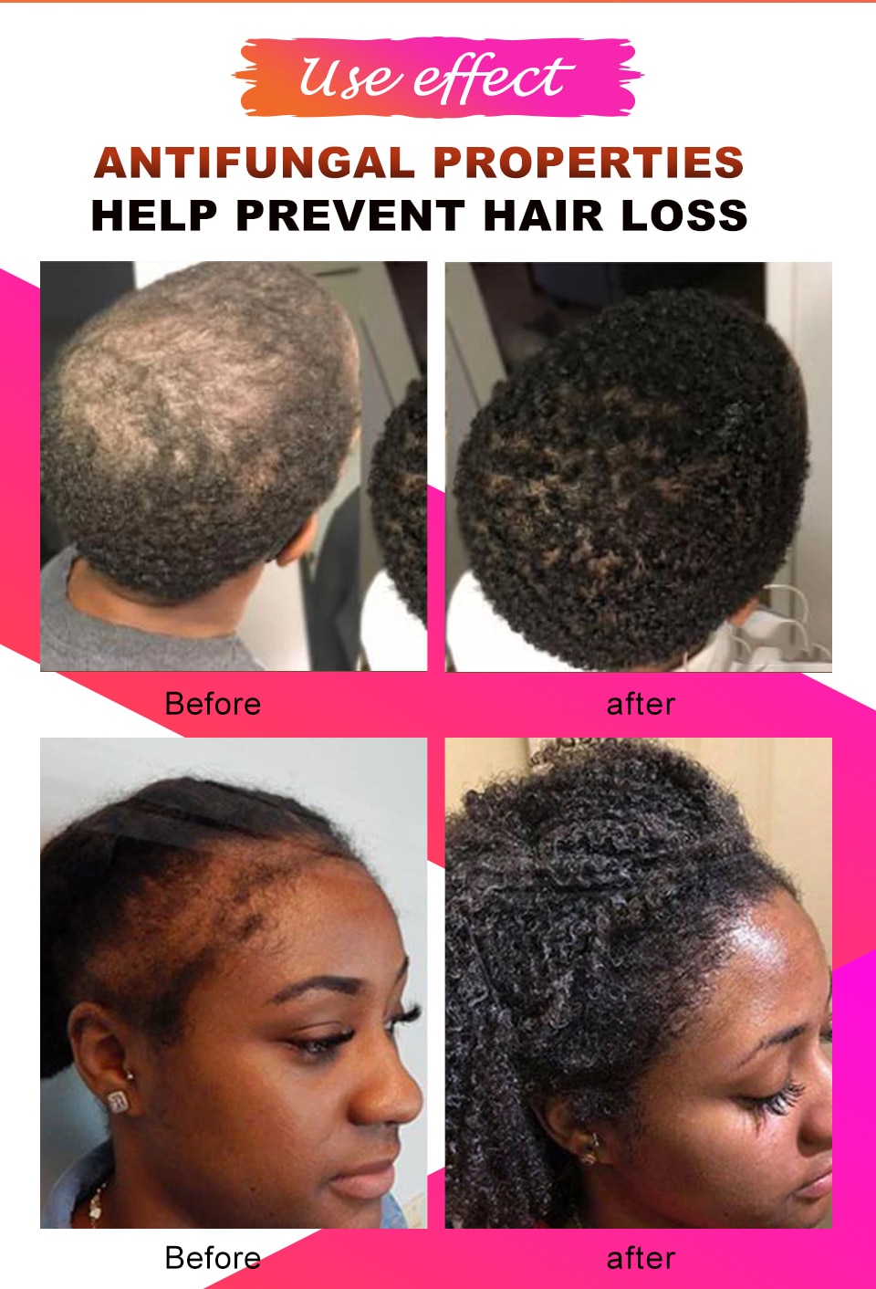 All Chebe Product Crazy Hair Growth Oil African Traction Alopecia Chebe Powder Serum Edges Anti Hair Loss Treatment Spray Sevich